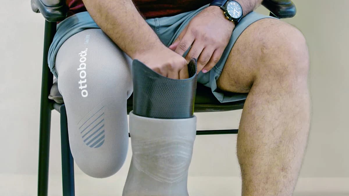 Lower limb amputee with Ottobock liner sitting on a chair holding his prosthetic socket