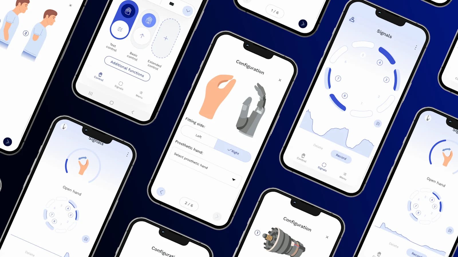 Miyoelektrik ayar için connectgrip uygulama arayüzü