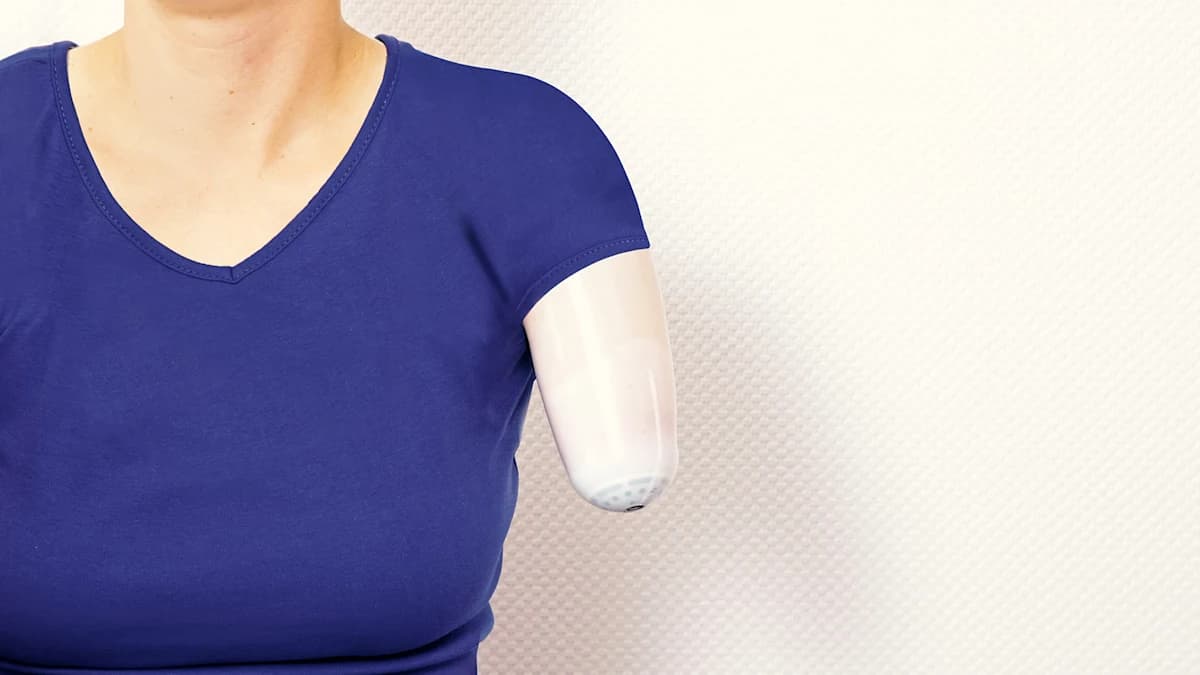 An amputee wearing a silicone liner covering their residual limb
