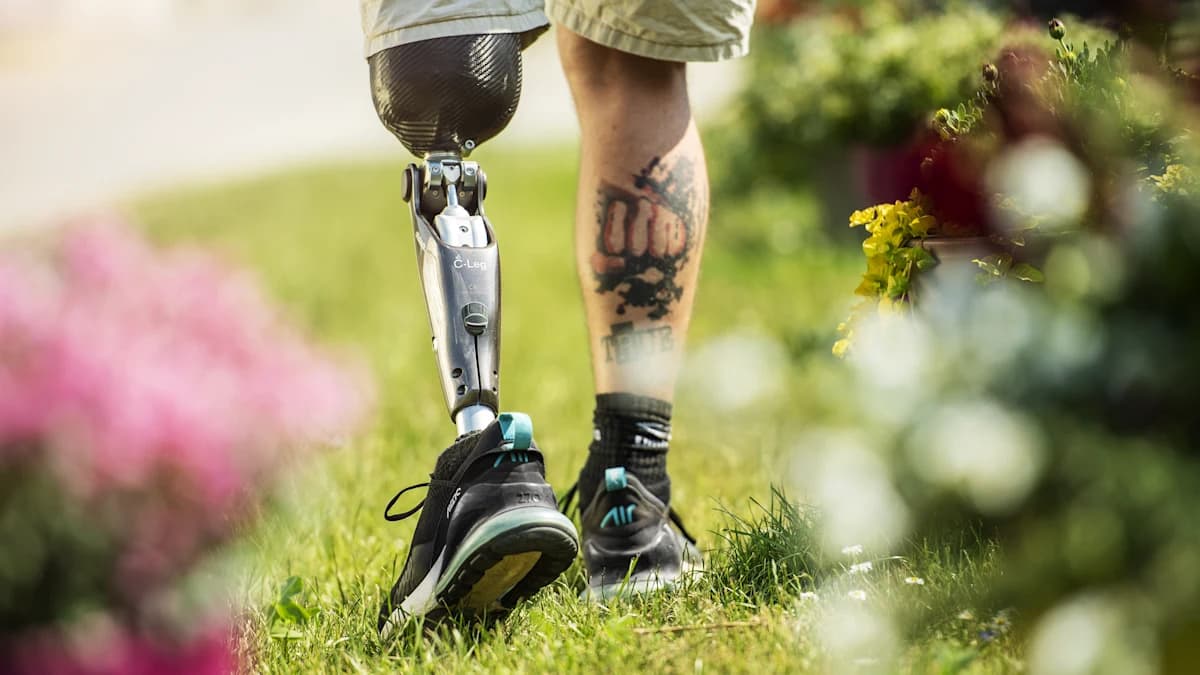 Man walking outdoors with his prosthetic leg