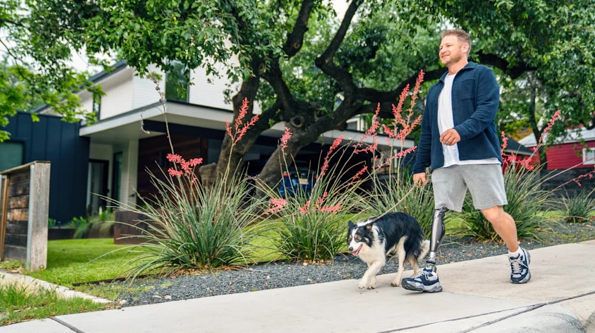 C-Leg 4 microprocessor knee user walking with a dog.