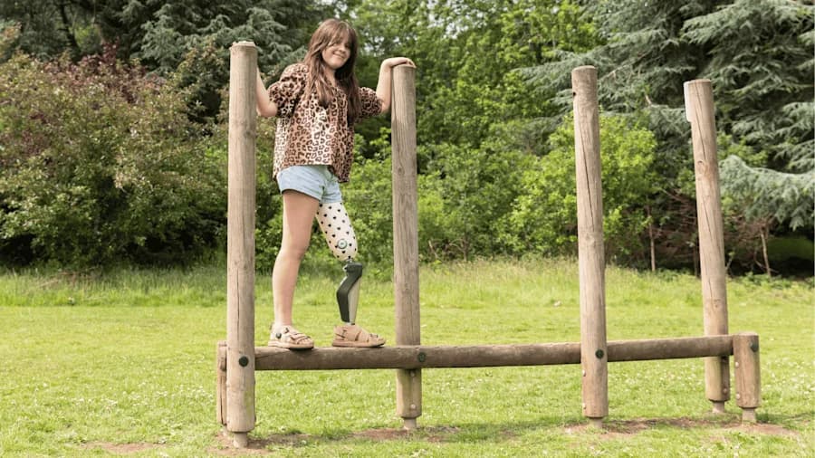Felicja, MPK Kids user with C-Leg