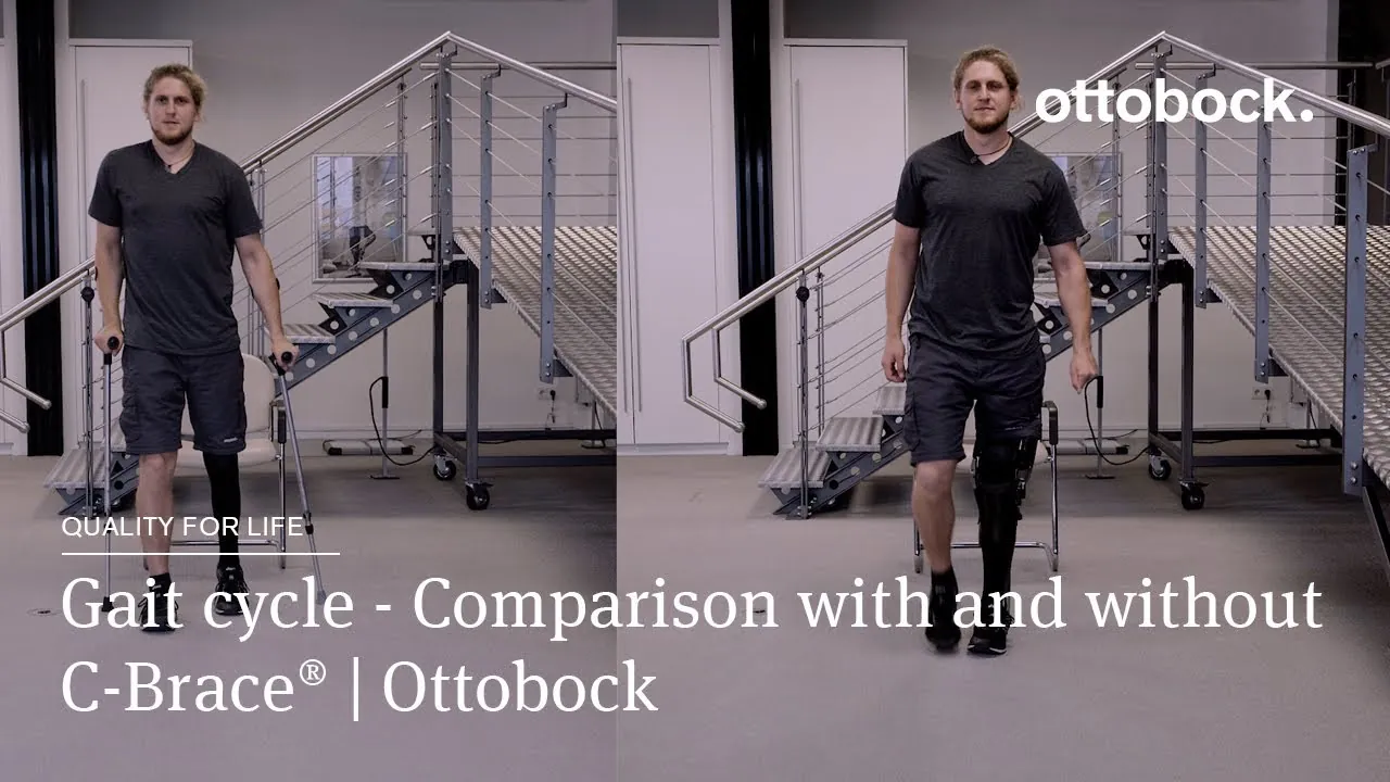 David — before/after C-Brace comparison