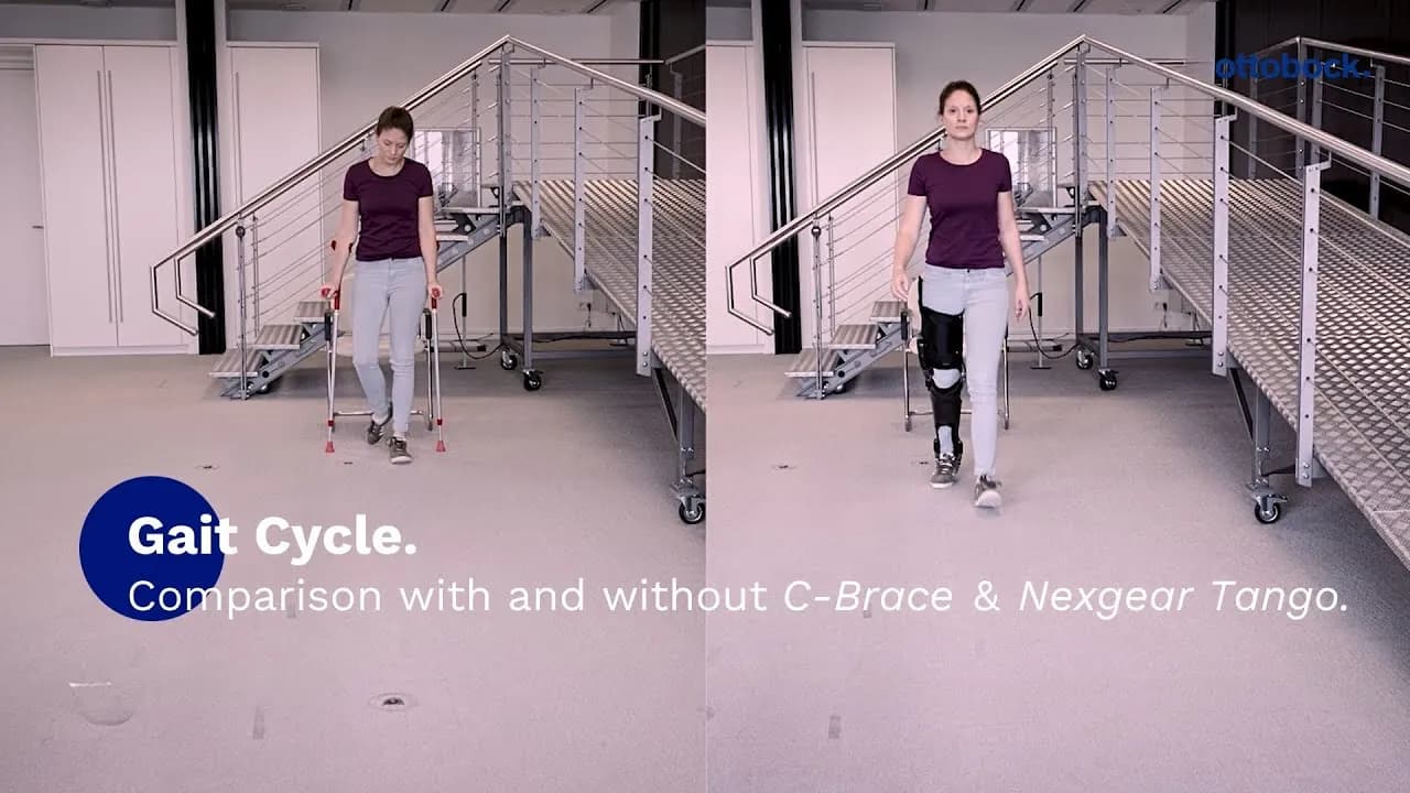 Denise — before/after C-Brace comparison