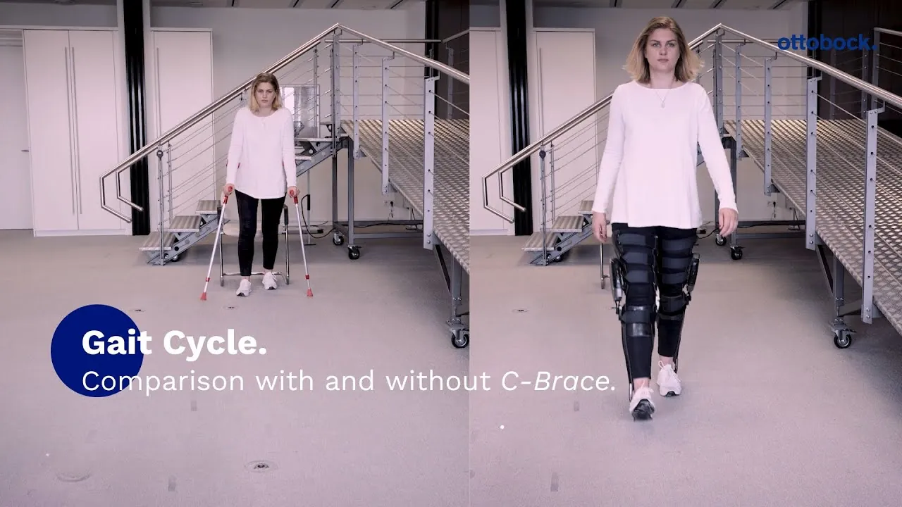 Rebecca — before/after C-Brace comparison