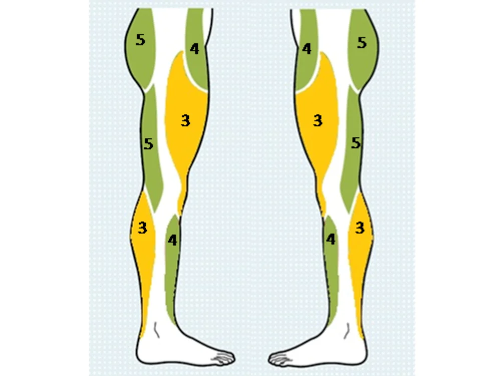 Gait analysis diagram for Mr A.