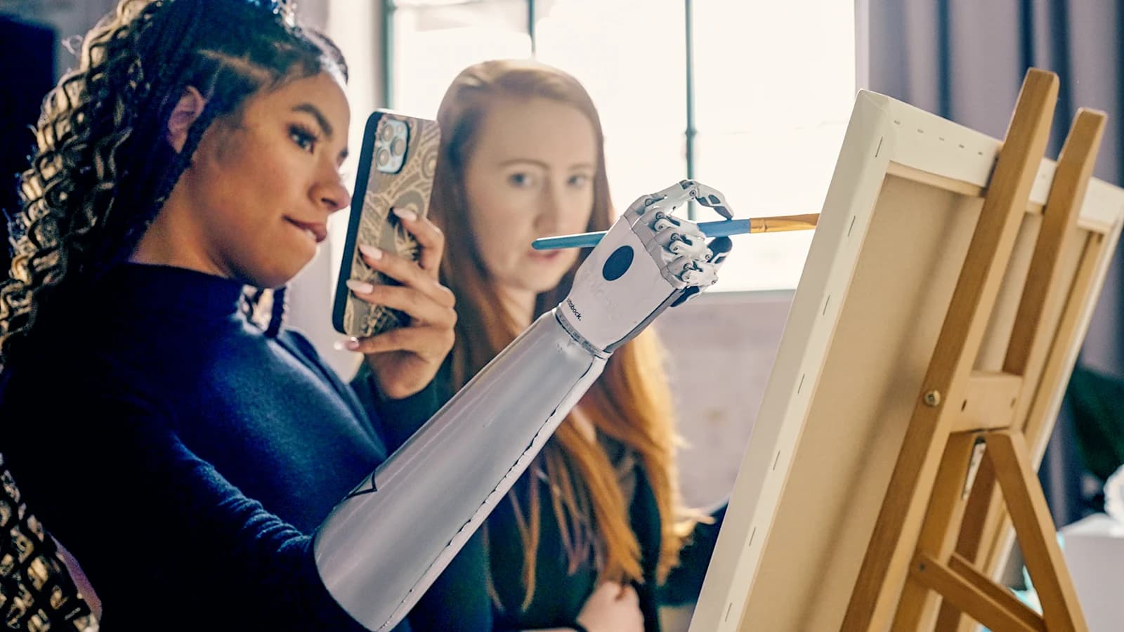 Person using an Ottobock upper limb prosthesis