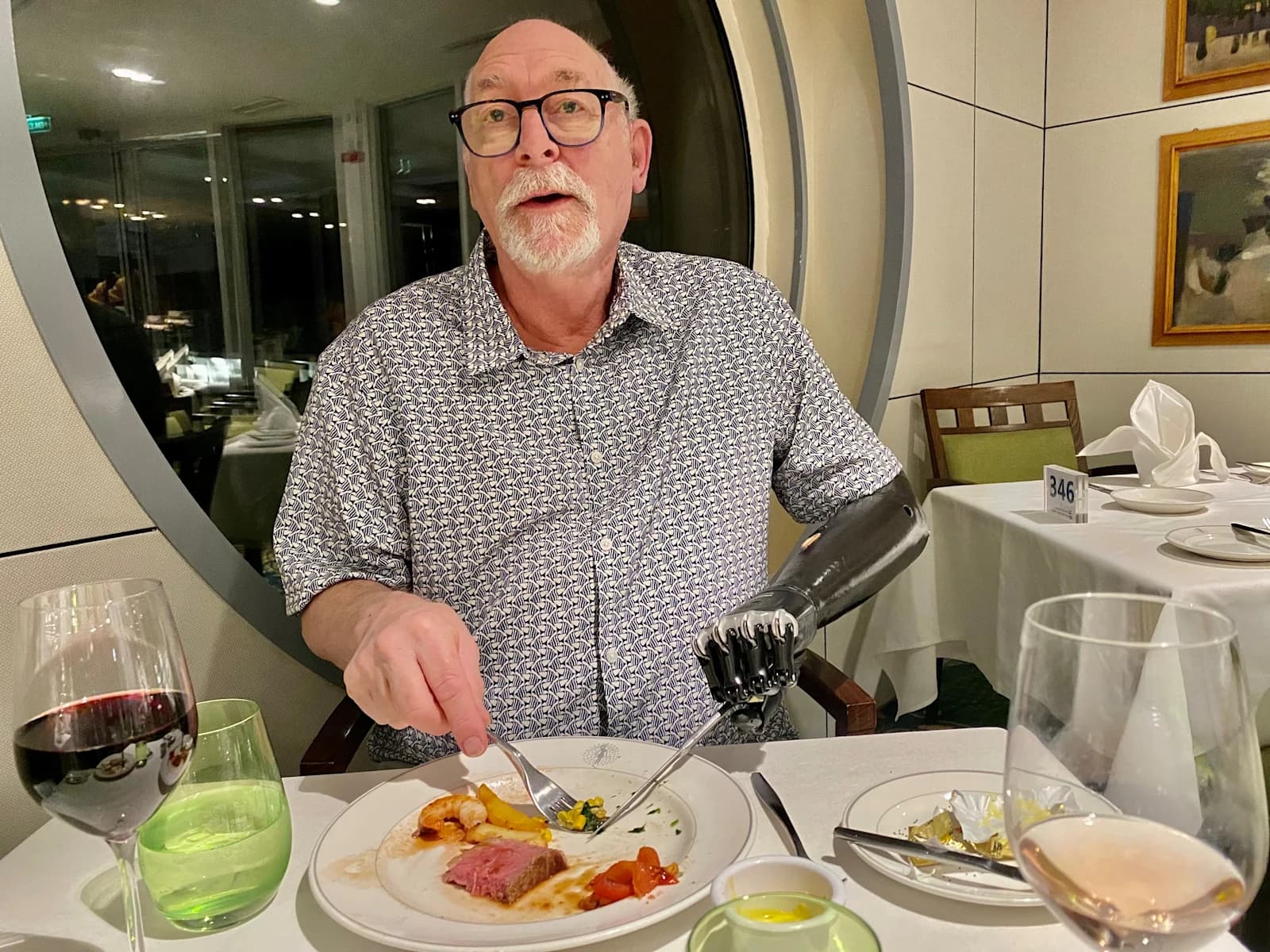 bebionic – Before
